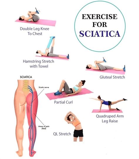 Yoga For Sciatica, Sciatica Pain Relief, Sciatic Pain, Chronic Sciatica, Sacroiliac, Sciatica ...