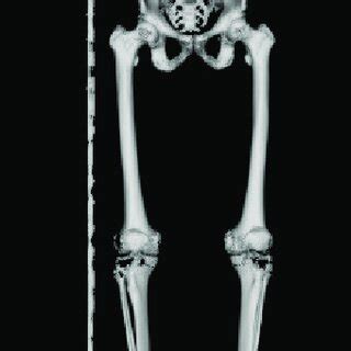 InVesalius Tutorial 的图像结果