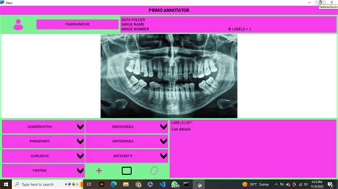 Image result for Kivymd Tutorial