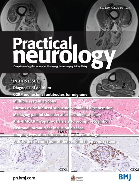 Nitrous oxide-induced subacute combined degeneration of the cord ...