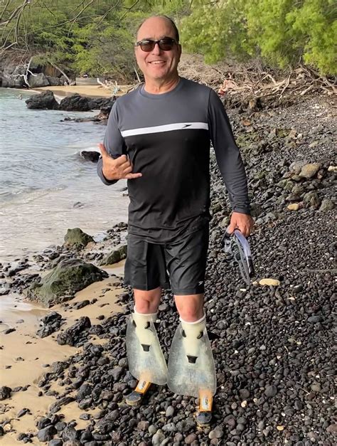 Osseointegration below knee amputations: snorkeling fins - shinfin™ leg fins