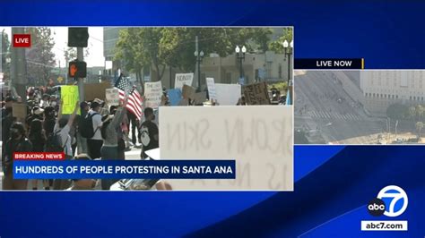 Protesters recount bloody attack by Homeland Security agents in Santa Ana