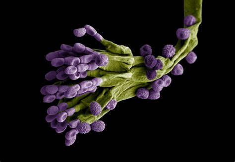 Penicillium notatum | fungus | Britannica