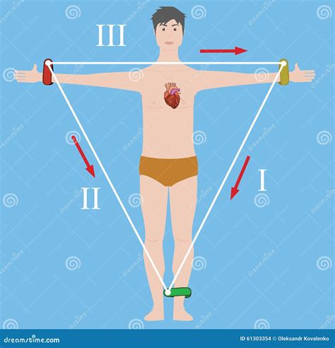 Einthoven ECG Triangle, Including Augmented Unipolar Limb Lead Royalty ...