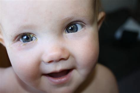 Micah and Rachel: Bye Bye Goopy Eye