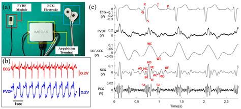 Cardiac Multi-Frequency Vibration Signal Sensor Module and Feature ...