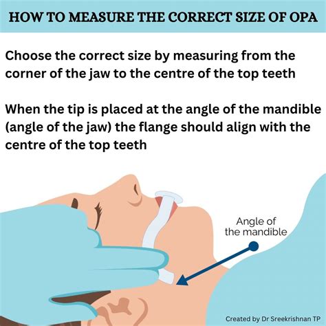 Dr Sreekrishnan T P on LinkedIn: How to measure the correct size of Oropharyngeal Airway