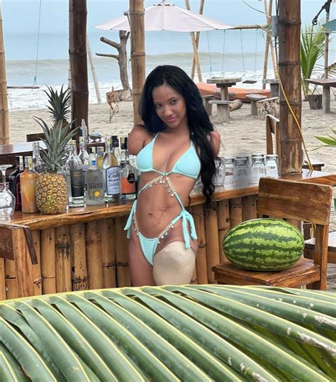 I'm a triple amputee and a hot model — nothing holds me back