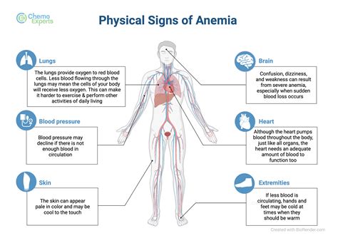 Anemia causes and treatment for cancer patients | ChemoExperts