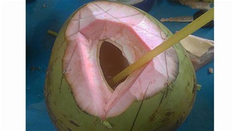 manfaat air kelapa wulung untuk asam lambung