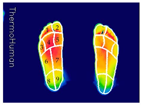 Thermal Response in Two Models of Socks with Different 3-D Weave ...