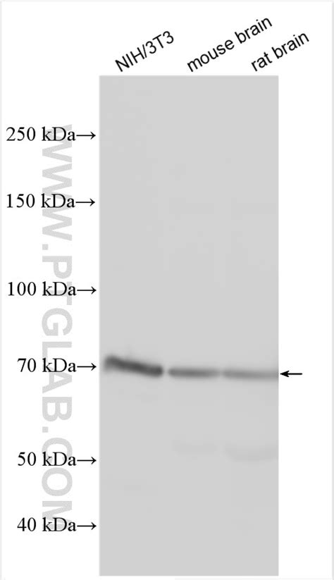 ADAM10 antibody (25900-1-AP) | Proteintech
