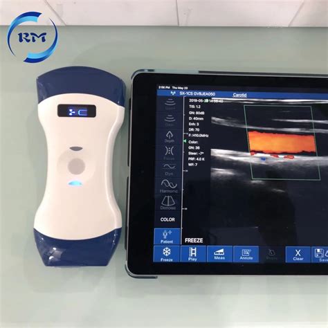 Color USG Doppler Ultrasonic System Handheld Pocket Ultrasound Machine - Ultrasound Probe and ...