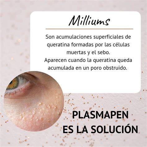 Milliums | Estetica de belleza, Equipos de estetica, Cremas para el acne