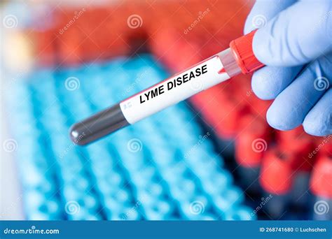 Lyme Disease. Lyme Disease Disease Blood Test Inmedical Laboratory ...