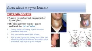 Image result for Thyroid Function Algorithm