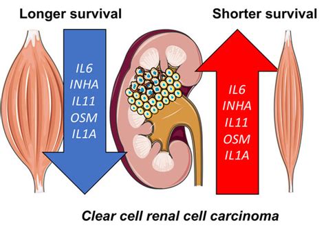 Cancers | Special Issue : Cancer Cachexia