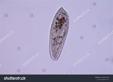 Labeled Paramecium Cell Under Microscope