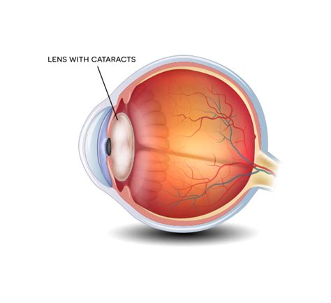 Jnanananda Ophthalmic Institute, Jnanananda Retina Foundation pvt ltd ...