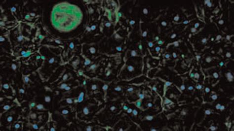 Image result for Phase Contrast Microscopy Applications