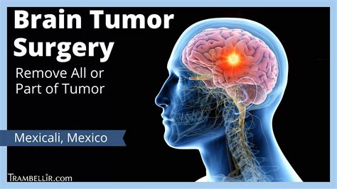Brain Tumor Surgery (Remove All or Part of Tumor) | Trambellir