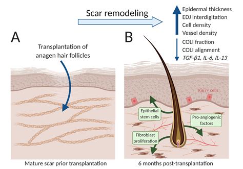 Scar Tissue Hair Follicles at Emil Bentley blog