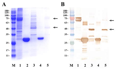 Identification of a Putative CFSH Receptor Inhibiting IAG Expression in ...