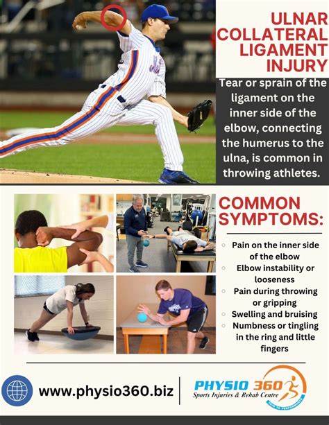 An ulnar collateral ligament (UCL) injury is a common condition that ...