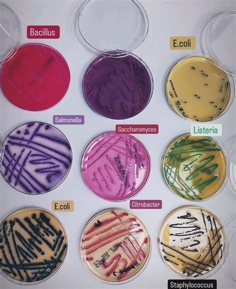 Macconkey agar plate purpose ingredients and principle – Artofit