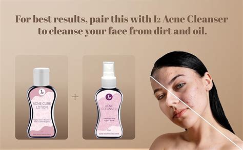 I2cure Acn Cure Lotion For Blackheads & Acne Prone Skin | Acne Marks ...
