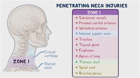 Video: Approach to penetrating neck injury: Clinical sciences | Osmosis