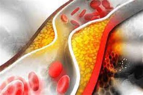 High Cholesterol Control Tips: ২০ টাকার পাঁচটি ফলই শরীর থেকে টেনে বের ...