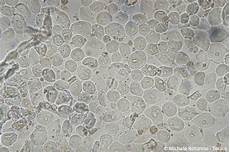 tappeto di emazie epithelial cells tappeto di emazie epithelial cells