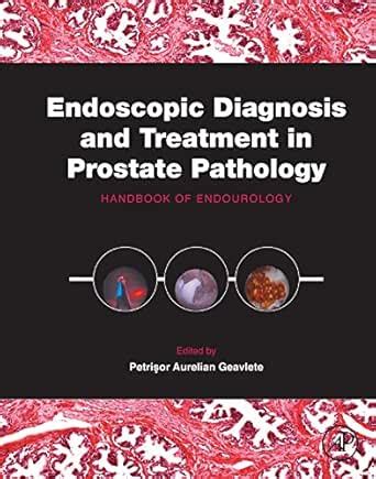 Endoscopic Diagnosis and Treatment in Prostate Pathology: Handbook of ...