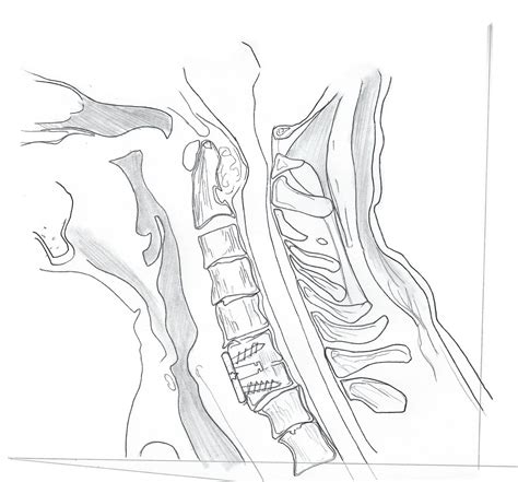 The Cervical Spine | Explore Spine Health — Yoshihiro Katsuura MD