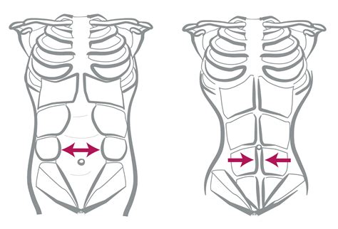 Rectus diastasis - separation of the tummy muscles - Body Organics
