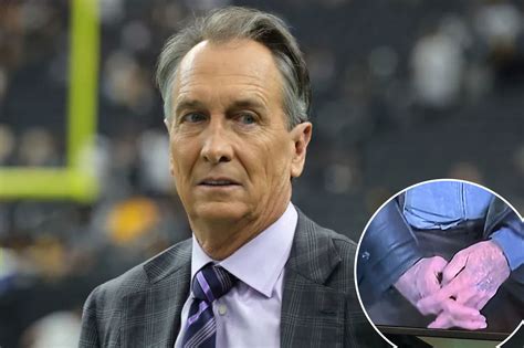 Cris Collinsworth’s hands had fans worried during 49ers-Bills game