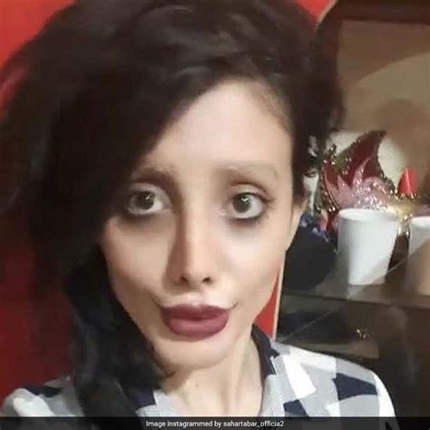 जानिए क्या है इन 50 सर्जरी की सच्चाई, बदसूरत नहीं लगती हैं इतनी खूबसूरत ...