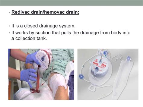 Drains & tubes used in surgery.pptx