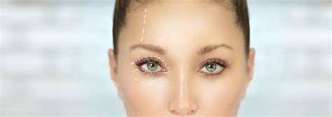 Articles | The Real Difference Between Upper and Lower Blepharoplasty