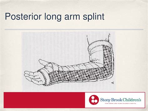 PPT - Comprehensive Guide to Splinting Techniques for Orthopedic ...