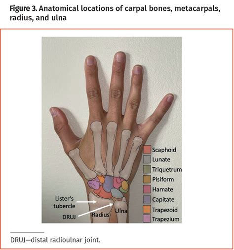 Approach to chronic wrist pain in adults | The College of Family ...