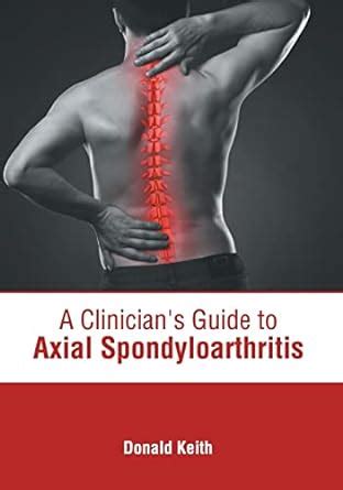 Buy A Clinician's Guide to Axial Spondyloarthritis Book Online at Low ...