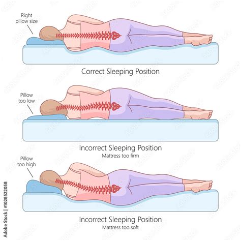 Image result for Proper Alignment