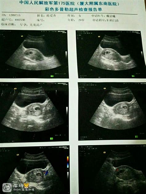 孕8周胎儿图_孕35周胎儿图片_孕6周胎儿图_孕三十七周胎儿图 - 7262图片网