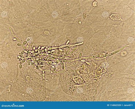 Budding Yeast In Urine