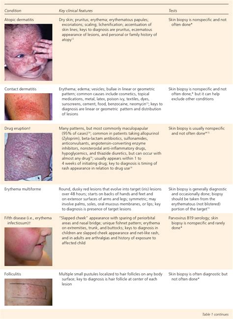 Image result for Rash Algorithm