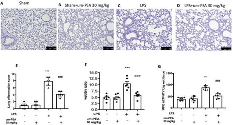 Management of Acute Lung Injury: Palmitoylethanolamide as a New Approach