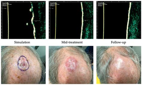 Dermatopathology | An Open Access Journal from MDPI