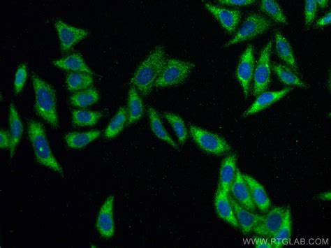 Serpin E1/PAI-1 antibody (66261-1-Ig) | Proteintech